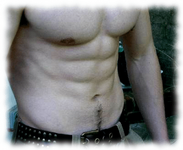 Epigenetics and diet