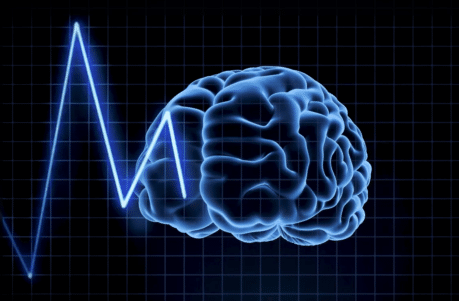 What is dynamic functional connectivity