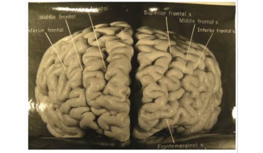Einstein's brain