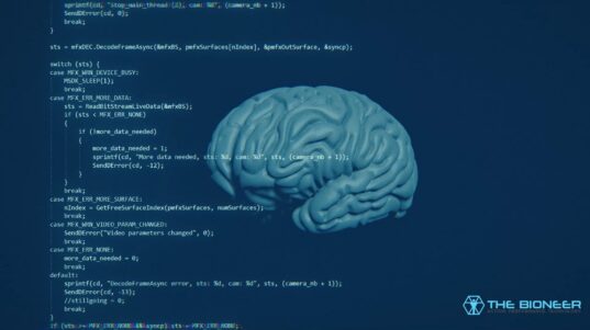 The brain is complicated