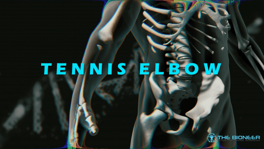 What is tennis elbow